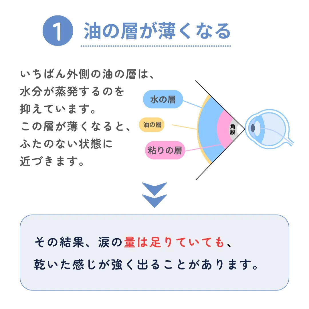 暖房をつけた日から、眼が乾く。